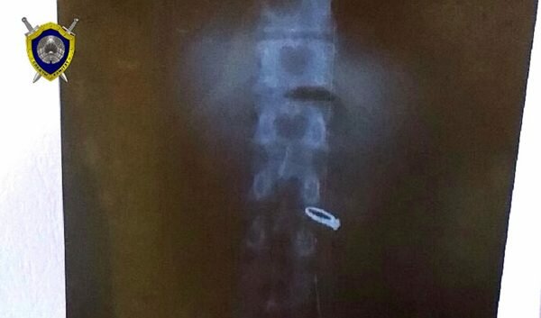 Проглотил кольцо, пока девушка отлучилась: необычную кражу украшения расследуют в Верхнедвинске. Фото СК